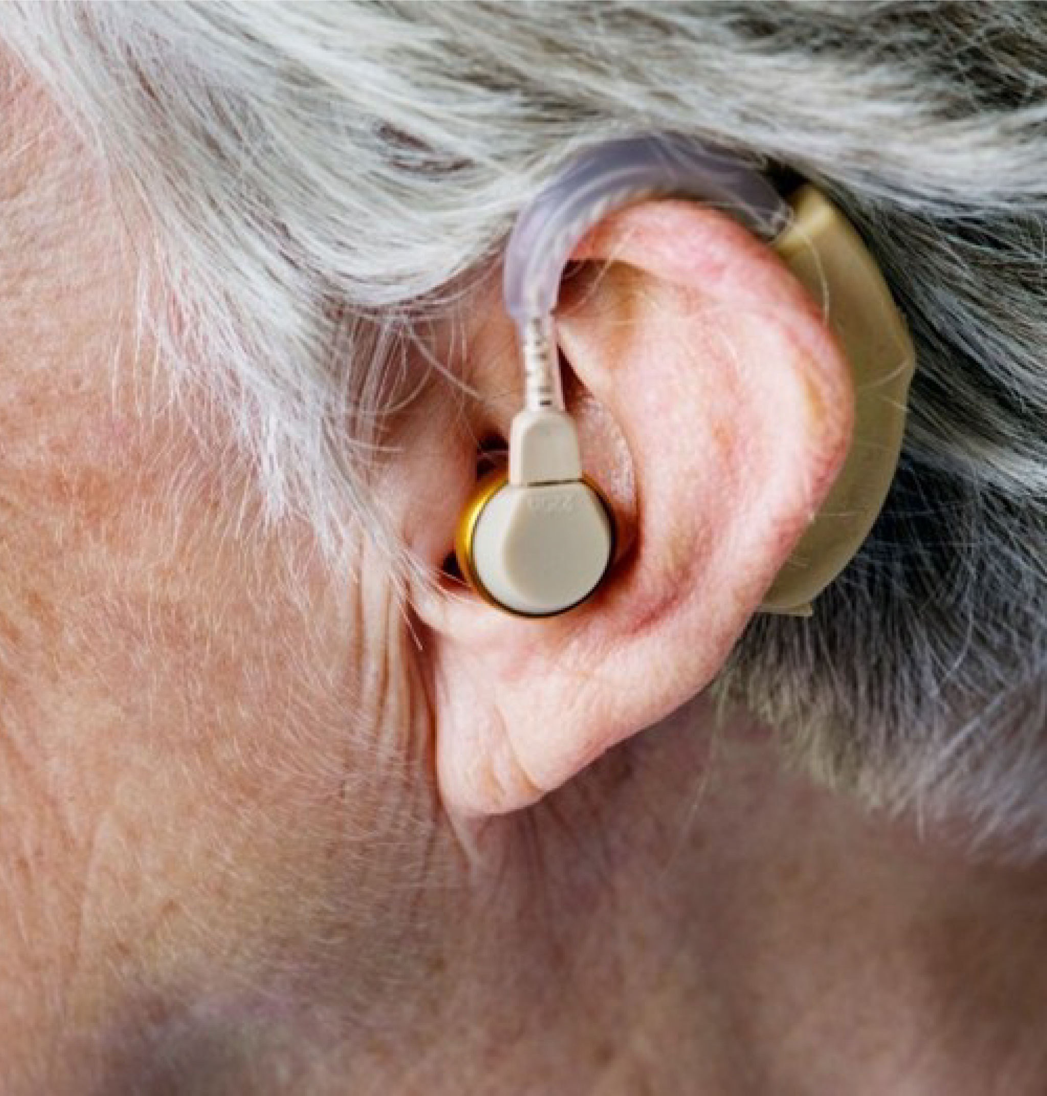 How Technology Can Help Prevent Hearing Loss?